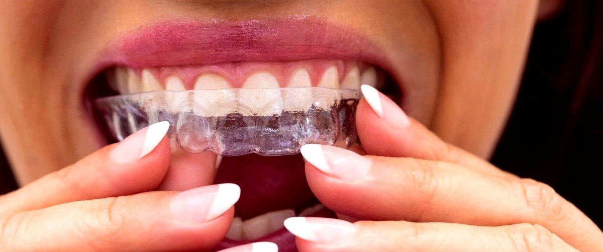 1. ¿Cuál es la duración promedio de un tratamiento de ortodoncia invisible?
