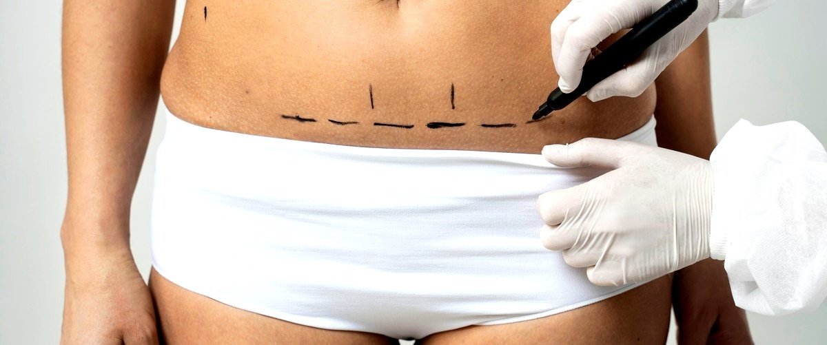 ¿Cuál es el precio aproximado de una abdominoplastia en Vigo (Pontevedra)?