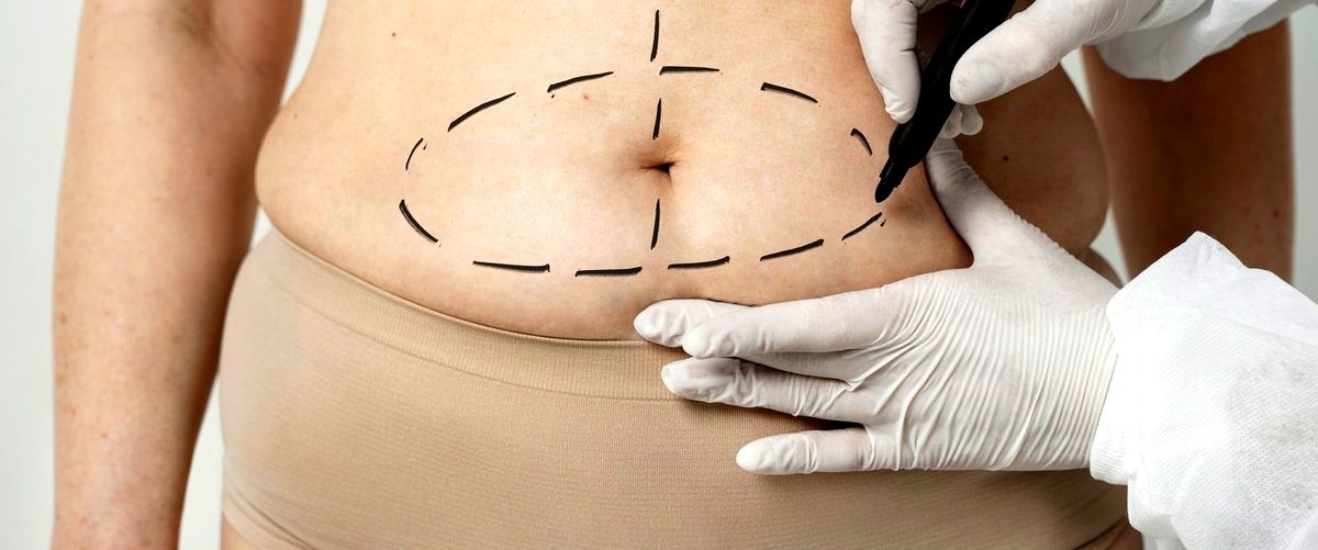 ¿Cuál es el precio aproximado de una abdominoplastia en Zaragoza?