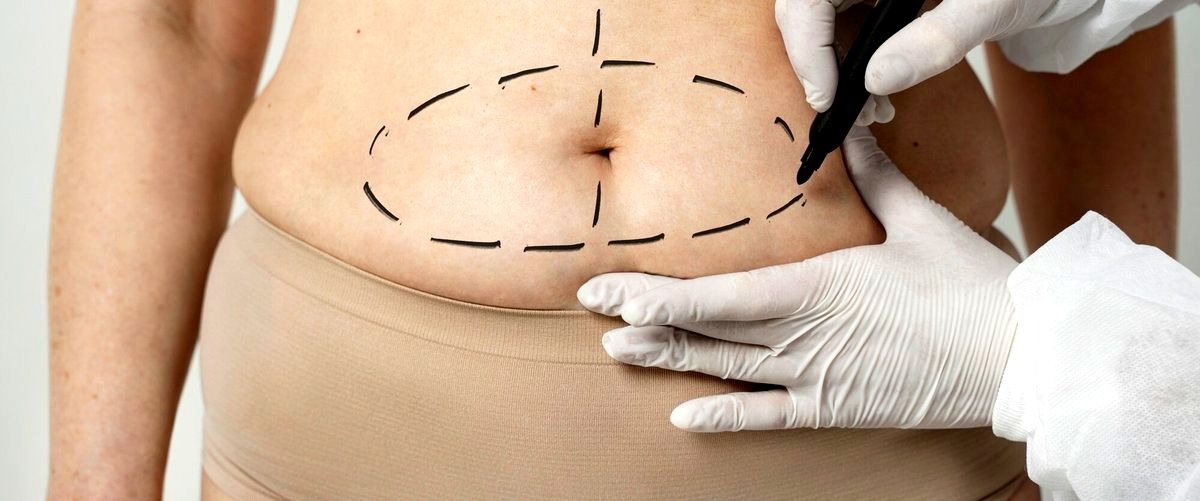 ¿Cuál es el precio de una mini abdominoplastia en Sant Cugat del Vallès (Barcelona)?