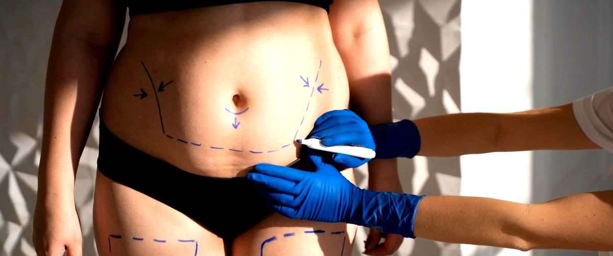 ¿Cuál es el precio promedio de una abdominoplastia en Teruel?