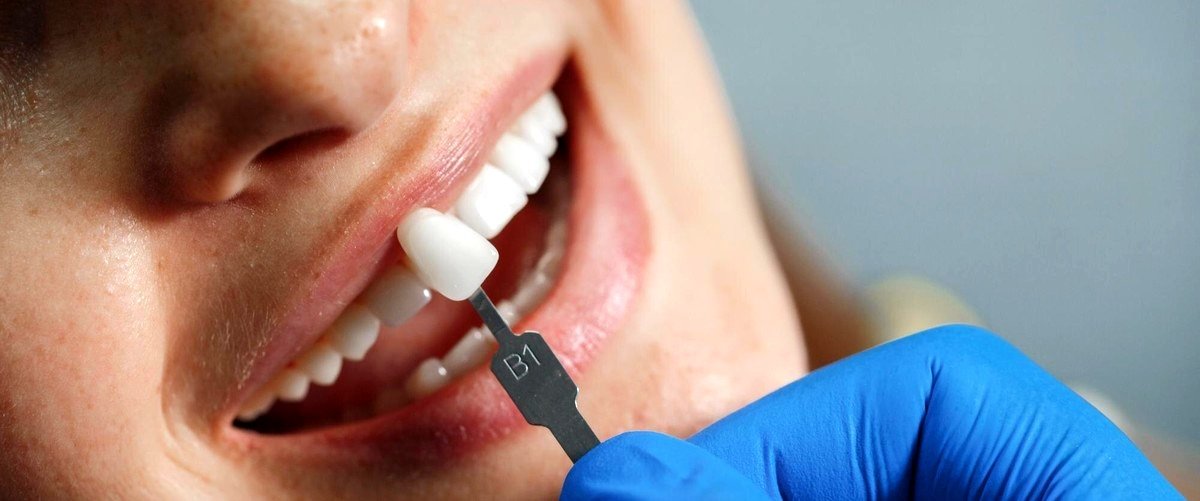 ¿Cuál es el nombre del médico especializado en la colocación de implantes dentales?