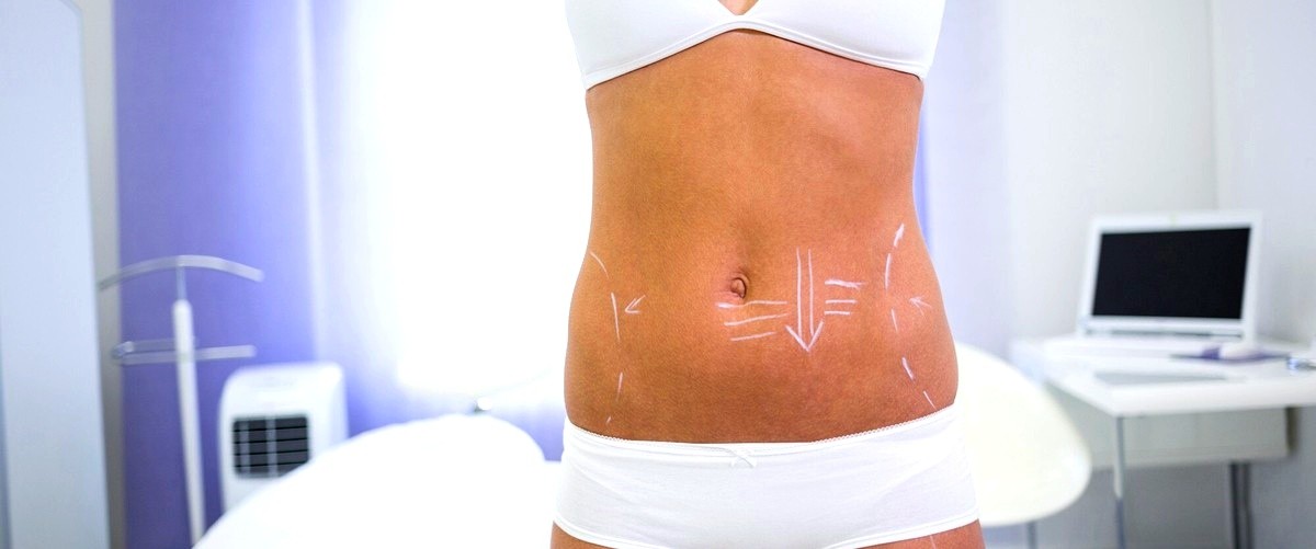 ¿Cuál es el tiempo de recuperación después de una abdominoplastia en Sevilla?