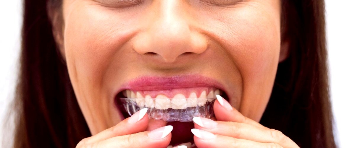 ¿Cuál opción es más económica, los brackets o Invisalign?