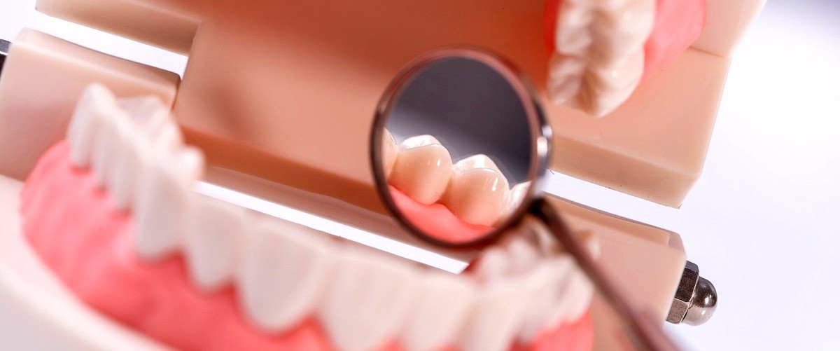 ¿Cuáles son los beneficios de los implantes dentales completos?
