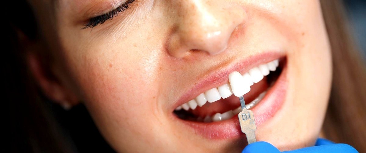 ¿Cuáles son los beneficios de utilizar ortodoncia invisible?