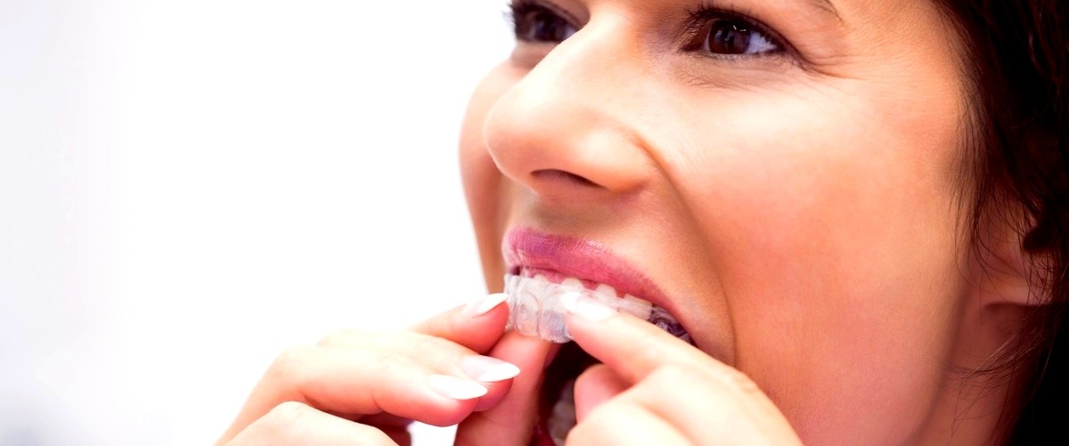 ¿Cuántas horas al día debo usar los alineadores de Invisalign?