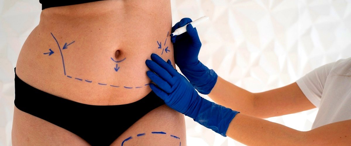 ¿Cuánto cuesta aproximadamente una abdominoplastia en Marbella?