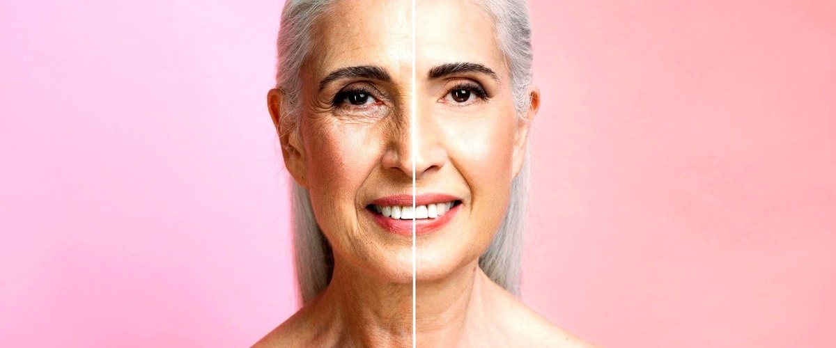 ¿Cuánto tiempo dura el efecto de la blefaroplastia?