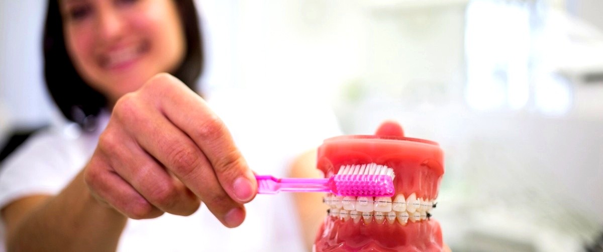 ¿Cuánto tiempo se tarda en completar el proceso de implantación dental?