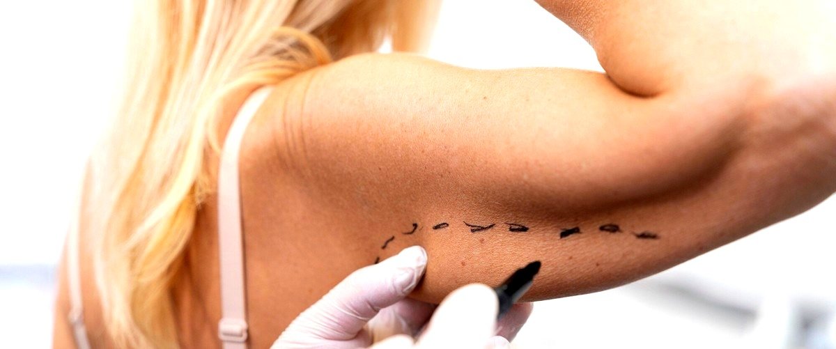 ¿En qué consiste la liposucción sin cirugía?