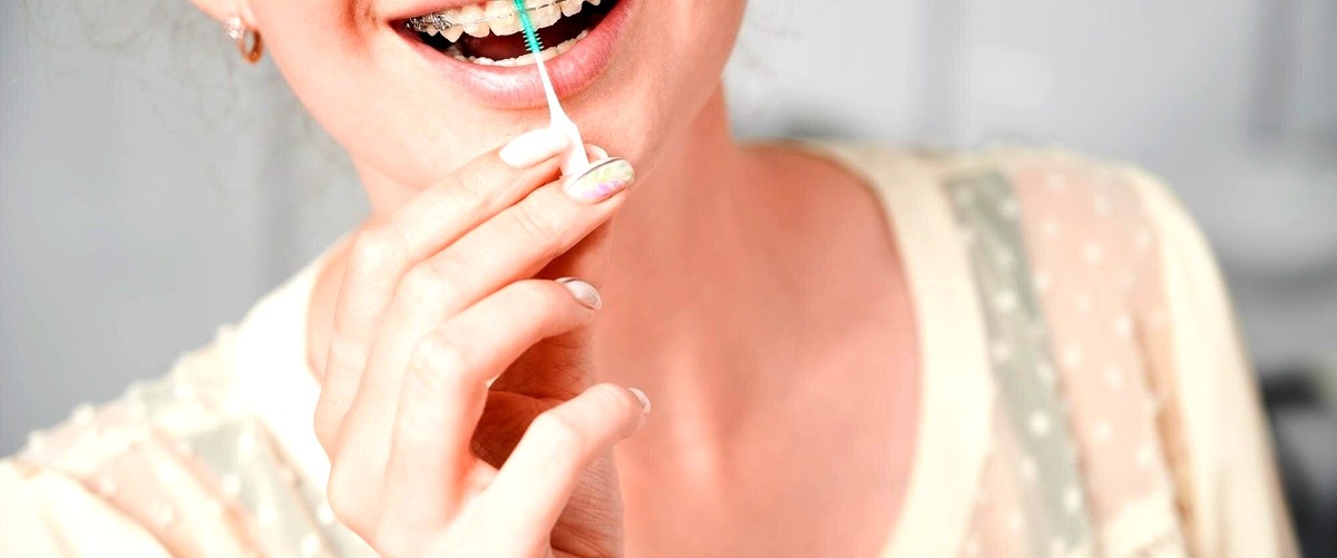 ¿Es necesario usar retenedores después de un tratamiento con Invisalign?