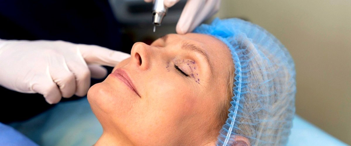 ¿Es posible corregir una rinoplastia previa que no quedó como se esperaba?