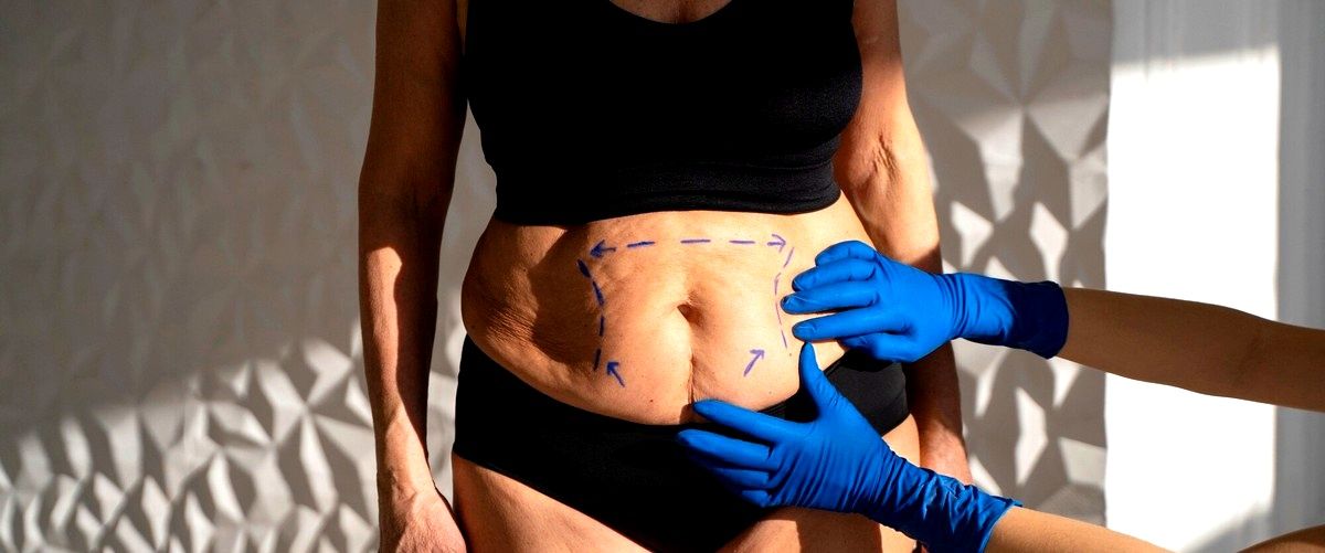 ¿Es posible eliminar la celulitis mediante la liposucción?