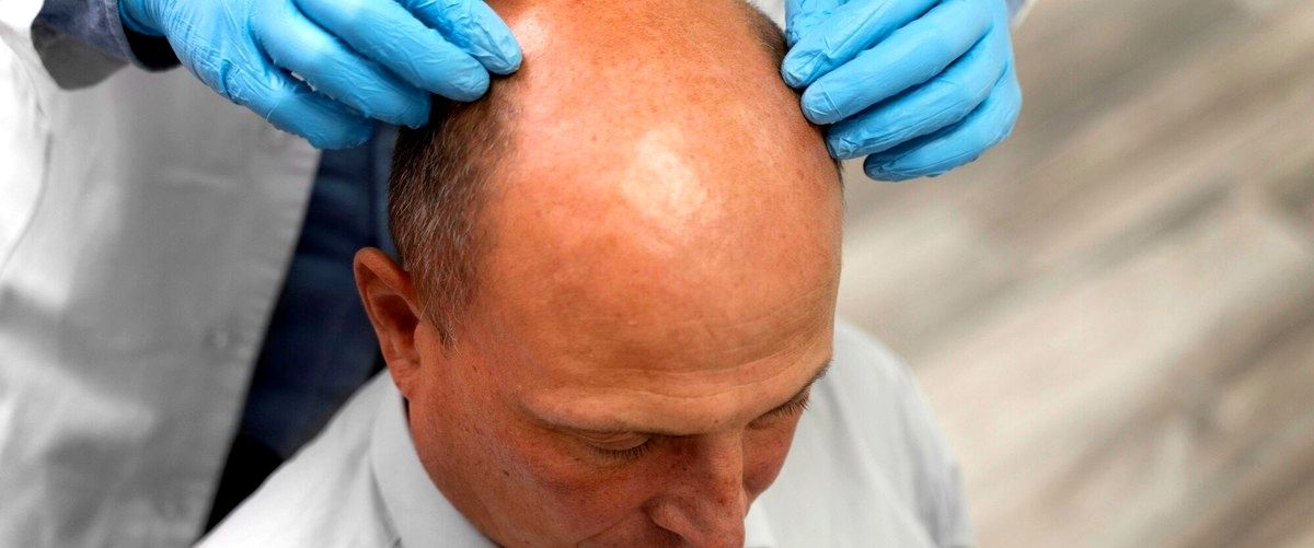 ¿Es posible realizar un trasplante de cabello en mujeres?