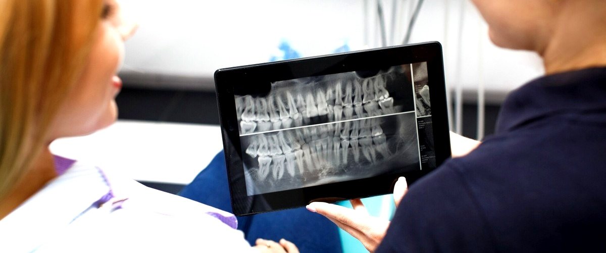 ¿Qué cuidados se deben tener después de la colocación de un implante dental?