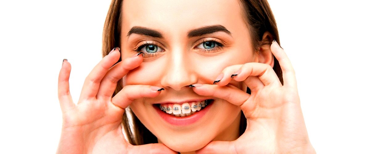 ¿Qué es más económico, los brackets o el tratamiento con Invisalign en Marbella (Málaga)?