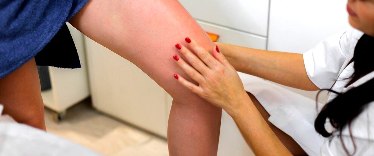 ¿Qué especialista se encarga del tratamiento de las varices en las piernas?