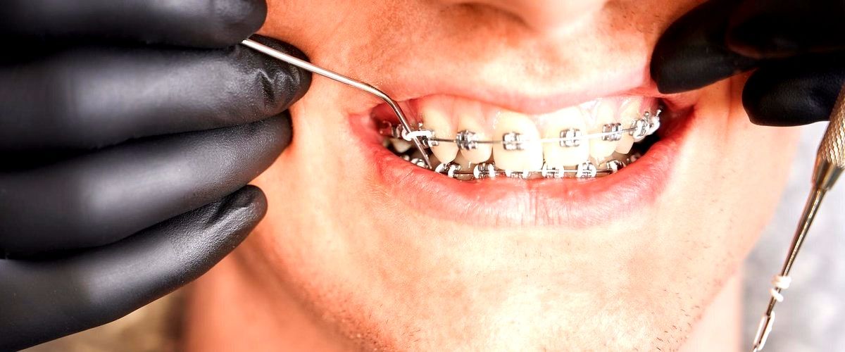 ¿Qué tipo de problemas dentales puede tratar un ortodoncista?