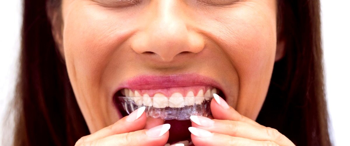 ¿Qué tipo de problemas dentales pueden ser corregidos con ortodoncia invisible?