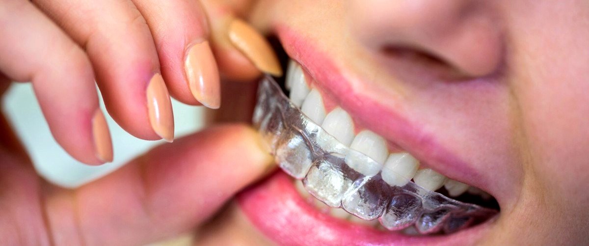 ¿Se puede realizar ortodoncia invisible en casos de maloclusión severa?