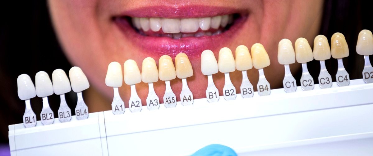 ¿Se puede realizar un implante dental en una persona mayor?